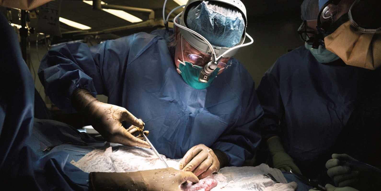 Cirurgiões testaram com sucesso o rim de um porco em um paciente humano
