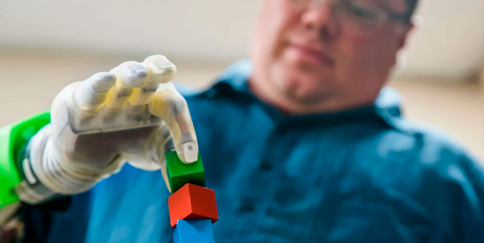 Implante usa machine learning para que amputados tenham controle sobre mãos protéticas