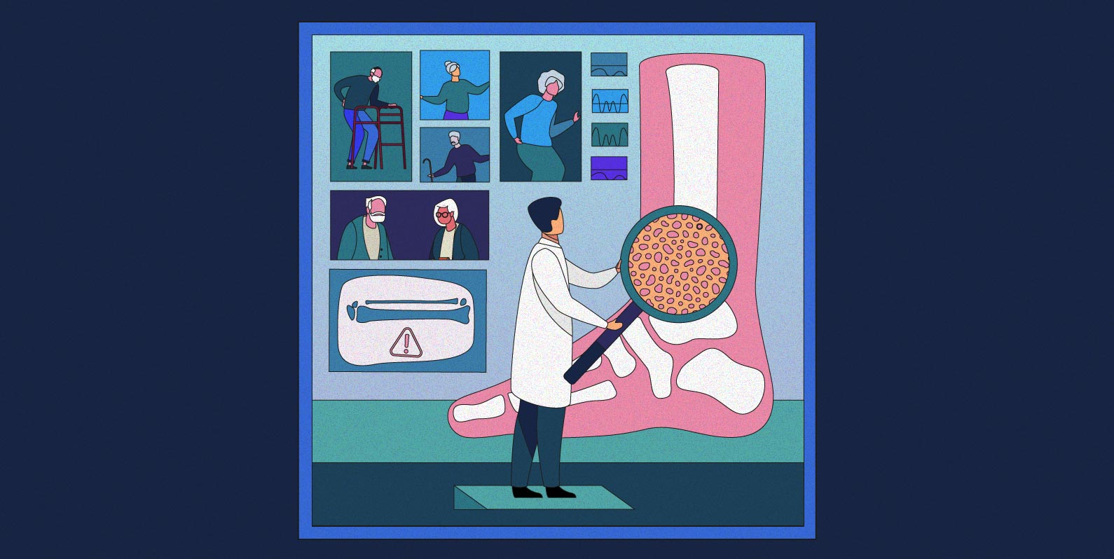 Mapear riscos otimiza tratamentos para osteoporose