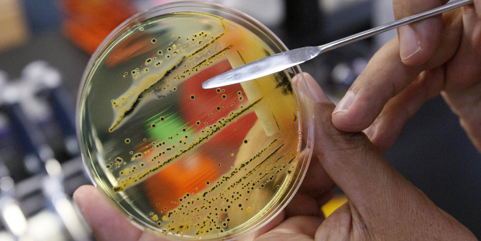 Superbactérias se alastram, e falta de dados preocupa cientistas