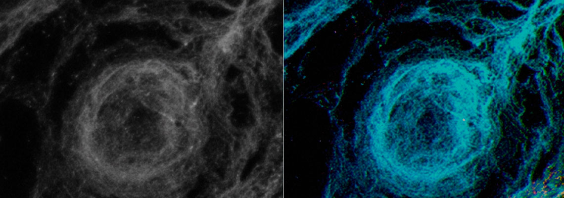Imagem a laser permite enxergar mais fundo em tecidos vivos