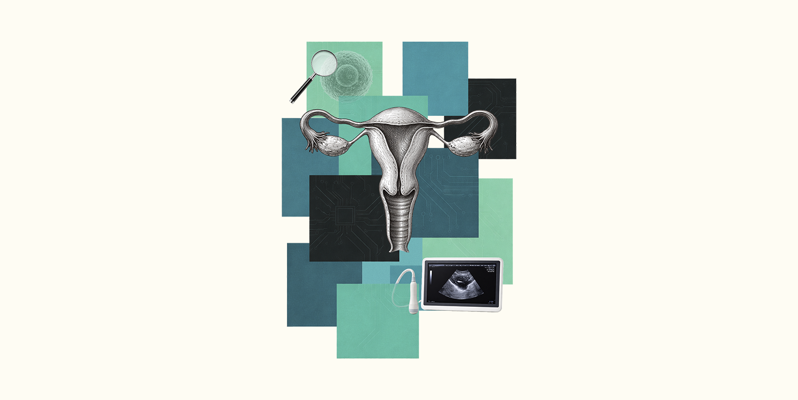 Endometriose: avanço tecnológico e lacunas no diagnóstico